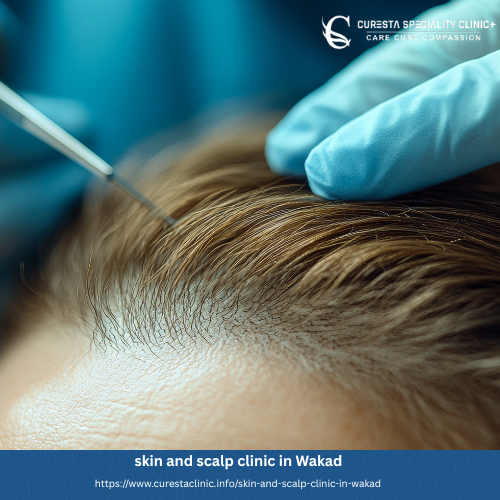 skin and scalp clinic in Wakad